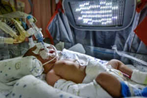 Meconium Aspiration Syndrome Lawyers | Birth Injury Lawyers Group Meconium Aspiration Syndrome Lawyer