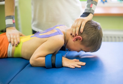 How common are speech disabilities among people with Cerebral Palsy?