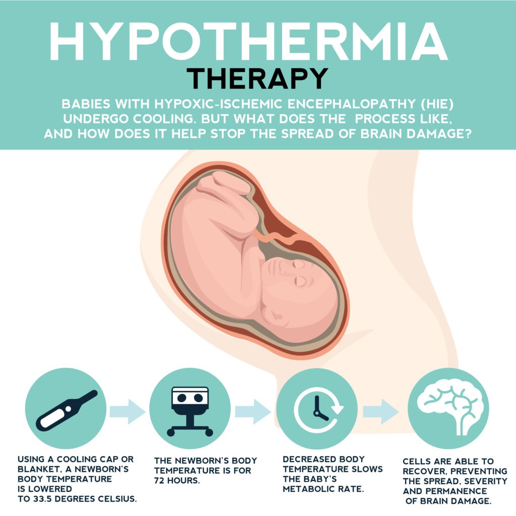 neonatal-therapeutic-hypothermia-birth-injury-lawyers-group