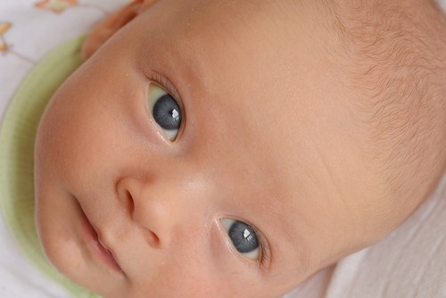 jaundice baby eyes