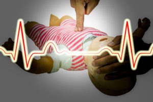 What Causes the Need for Infant Resuscitation?