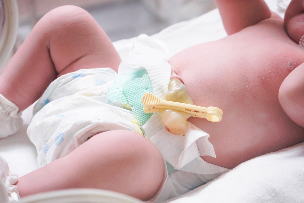 Can I Sue for Future Medical Expenses and Long-Term Care? Umbilical Cord Birth Injuries