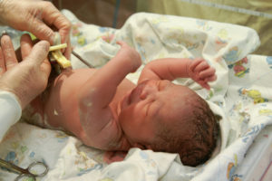 How Can Umbilical Cord Birth Injury During Childbirth Be Prevented