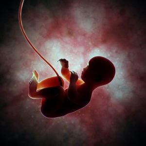 What Are The Different Kinds Of Umbilical Cord Birth Injuries You Can Sue for