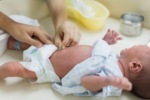 What Types of Malpractice Cause Umbilical Cord Birth Injuries