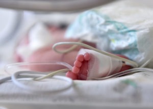 How Common Is Hemorrhagic Disease of a Newborn?