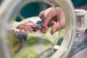 Call our Delaware birth asphyxia attorneys if your child suffered from birth asphyxia. You may be owed significant compensation for their injuries.