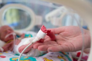 Is There a Link Between Premature Birth and Autistic Spectrum Disorder?