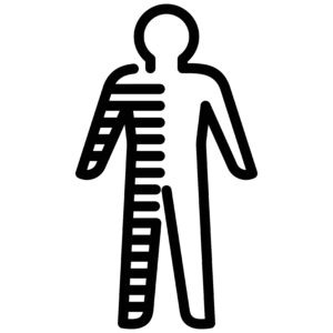 An image showing how spastic hemiplegia affects one side of the body.