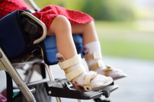 A photo of a child with cerebral palsy.